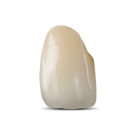 Porcelain-Fused-to-Zirconia